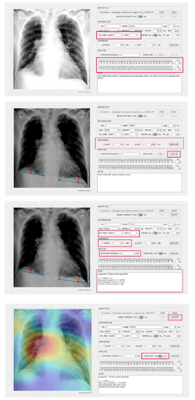 Development of machine learning for screening the risk of obstructive pulmonary disease